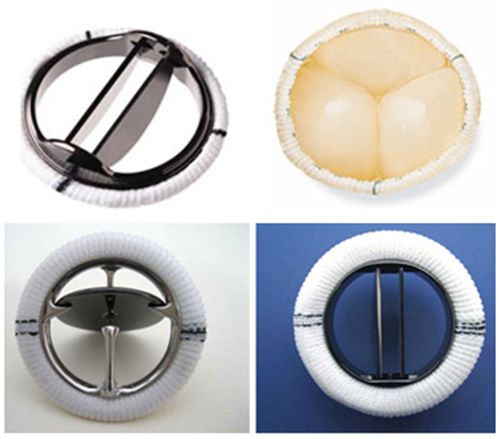 大自然地板告訴你:人工心臟的材料用在地板上會有多神奇! 大自然地板告訴你:人工心臟的材料用在地板上會有多神奇!